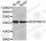 Serpin Family B Member 10 antibody, A3319, ABclonal Technology, Western Blot image 