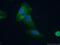 Protein Tyrosine Kinase 2 antibody, 66258-1-Ig, Proteintech Group, Immunofluorescence image 
