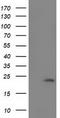 Superoxide Dismutase 2 antibody, CF501887, Origene, Western Blot image 