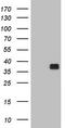 Ornithine Carbamoyltransferase antibody, TA802680S, Origene, Western Blot image 