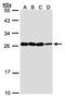 Jupiter Microtubule Associated Homolog 1 antibody, LS-C109400, Lifespan Biosciences, Western Blot image 