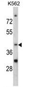 Nocturnin antibody, AP17195PU-N, Origene, Western Blot image 