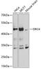 Origin Recognition Complex Subunit 4 antibody, GTX66502, GeneTex, Western Blot image 