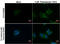 Sequestosome 1 antibody, GTX100685, GeneTex, Immunocytochemistry image 