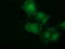 NSE2 (MMS21) Homolog, SMC5-SMC6 Complex SUMO Ligase antibody, LS-C115576, Lifespan Biosciences, Immunofluorescence image 