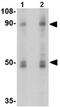 Sodium/hydrogen exchanger 1 antibody, ab67314, Abcam, Western Blot image 