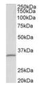 rRNA 2 -O-methyltransferase fibrillarin antibody, orb12327, Biorbyt, Western Blot image 