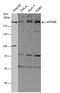 Autophagy Related 2A antibody, GTX132260, GeneTex, Western Blot image 