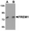 FRAS1 Related Extracellular Matrix 1 antibody, LS-B5486, Lifespan Biosciences, Western Blot image 