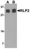 RILP-like protein 2 antibody, orb75781, Biorbyt, Western Blot image 