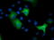 Epoxide Hydrolase 2 antibody, TA501761, Origene, Immunofluorescence image 
