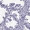 Opa Interacting Protein 5 antibody, HPA052271, Atlas Antibodies, Immunohistochemistry paraffin image 