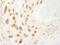 Promyelocytic Leukemia antibody, IHC-00241, Bethyl Labs, Immunohistochemistry paraffin image 