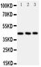 C-C Motif Chemokine Receptor 9 antibody, PA2122, Boster Biological Technology, Western Blot image 