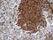 67 kDa laminin receptor antibody, LS-C795944, Lifespan Biosciences, Immunohistochemistry paraffin image 