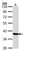 Corticosteroid-binding globulin antibody, TA308269, Origene, Western Blot image 