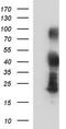 Transforming Growth Factor Beta 1 Induced Transcript 1 antibody, TA590254, Origene, Western Blot image 