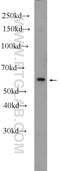 Abhydrolase Domain Containing 18 antibody, 25036-1-AP, Proteintech Group, Western Blot image 