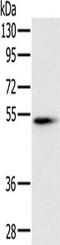 Pancreatic Lipase antibody, TA350265, Origene, Western Blot image 