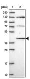 Chromosome 6 Open Reading Frame 163 antibody, NBP1-94165, Novus Biologicals, Western Blot image 