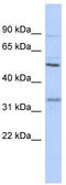Serine Protease 35 antibody, TA337834, Origene, Western Blot image 