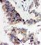 Angiopoietin 1 antibody, PA1333-1, Boster Biological Technology, Immunohistochemistry paraffin image 
