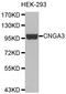 Cyclic Nucleotide Gated Channel Alpha 3 antibody, LS-B13903, Lifespan Biosciences, Western Blot image 