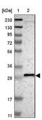 Cadherin Like And PC-Esterase Domain Containing 1 antibody, NBP1-93947, Novus Biologicals, Western Blot image 