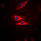 Phospholipase A2 Group IVA antibody, LS-C354045, Lifespan Biosciences, Immunofluorescence image 