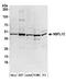 NSFL1 Cofactor antibody, A304-565A, Bethyl Labs, Western Blot image 