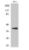 Hydroxy-Delta-5-Steroid Dehydrogenase, 3 Beta- And Steroid Delta-Isomerase 7 antibody, A10025, Boster Biological Technology, Western Blot image 