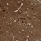 Chromosome 11 Open Reading Frame 87 antibody, HPA034656, Atlas Antibodies, Immunohistochemistry paraffin image 