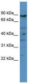 High affinity cAMP-specific and IBMX-insensitive 3 ,5 -cyclic phosphodiesterase 8A antibody, TA344623, Origene, Western Blot image 