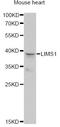 LIM Zinc Finger Domain Containing 1 antibody, LS-C748931, Lifespan Biosciences, Western Blot image 