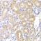 Pancreatic Lipase antibody, GTX33384, GeneTex, Immunohistochemistry paraffin image 