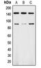 Neurotrophic Receptor Tyrosine Kinase 2 antibody, MBS822075, MyBioSource, Western Blot image 