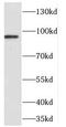 Cell Division Cycle 27 antibody, FNab01525, FineTest, Western Blot image 