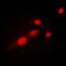 p65 antibody, orb223996, Biorbyt, Immunofluorescence image 