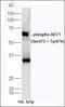 ATP Binding Cassette Subfamily G Member 8 antibody, orb155560, Biorbyt, Western Blot image 