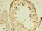 MORC Family CW-Type Zinc Finger 2 antibody, CSB-PA896555LA01HU, Cusabio, Immunohistochemistry frozen image 