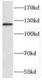 NCK Associated Protein 1 antibody, FNab05585, FineTest, Western Blot image 