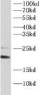 BCL2 Associated Agonist Of Cell Death antibody, FNab10244, FineTest, Western Blot image 