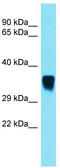 Sorting Nexin 15 antibody, TA331227, Origene, Western Blot image 