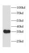 Calcium Voltage-Gated Channel Auxiliary Subunit Gamma 5 antibody, FNab01180, FineTest, Western Blot image 