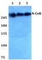 Nuclear receptor corepressor 1 antibody, A01304, Boster Biological Technology, Western Blot image 