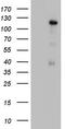 GLI Family Zinc Finger 1 antibody, CF803697, Origene, Western Blot image 