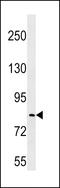 Leucine Rich Repeat Containing 70 antibody, 60-221, ProSci, Western Blot image 