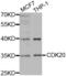 Cyclin Dependent Kinase 20 antibody, abx002060, Abbexa, Western Blot image 