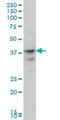 Musashi RNA Binding Protein 1 antibody, H00004440-M04, Novus Biologicals, Western Blot image 