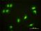 Cryptochrome Circadian Regulator 1 antibody, ab54649, Abcam, Immunocytochemistry image 